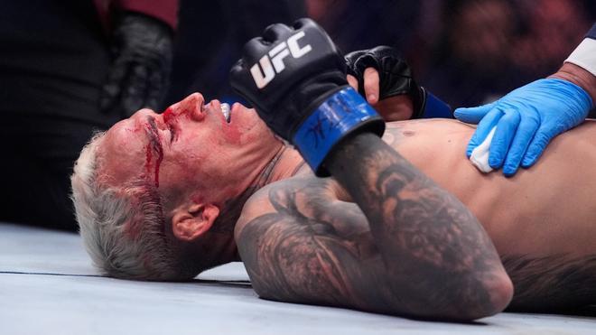 Oliveira rompe su silencio tras la derrota ante Topuria:
