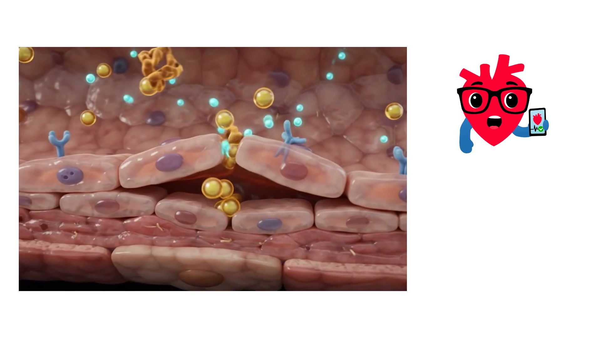 The arterial wall up close — where LDL takes root