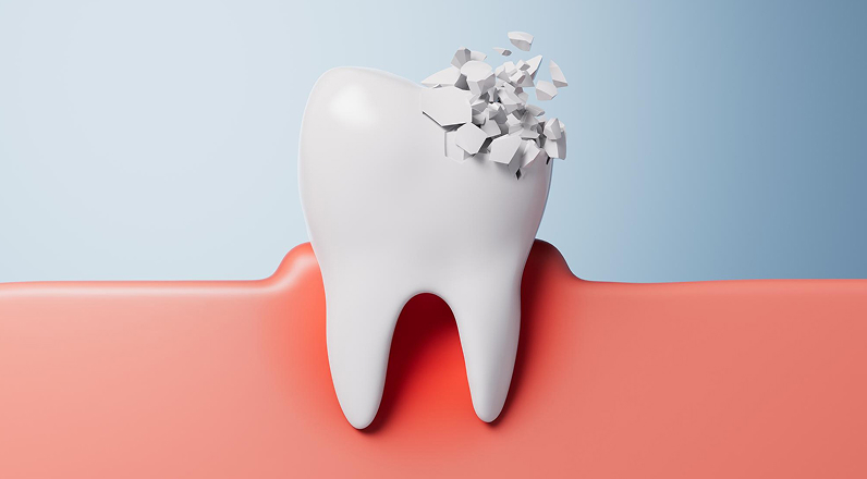 Dental infections and autoimmune diseases