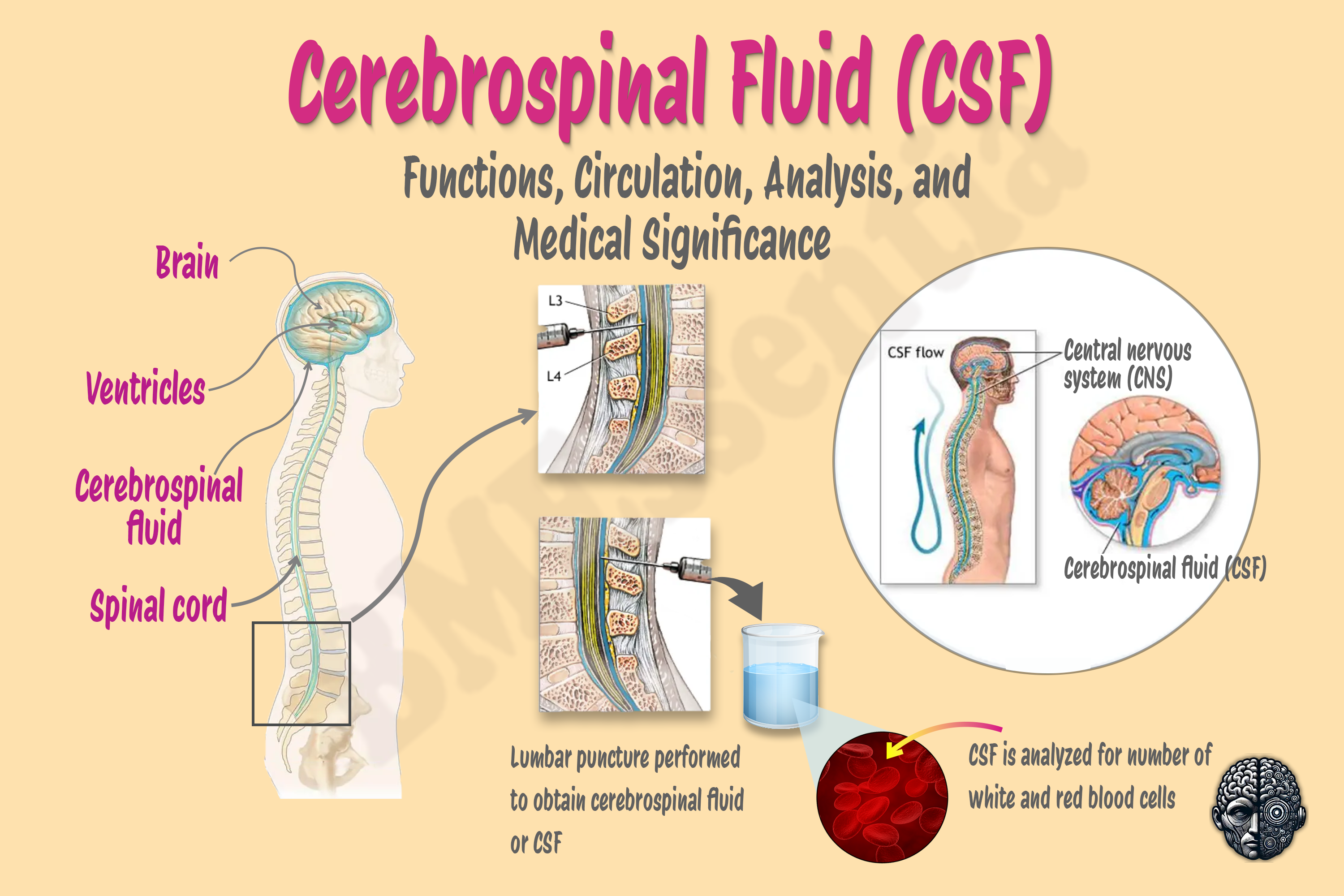 Cerebrospinal Fluid (CSF) Shunt System