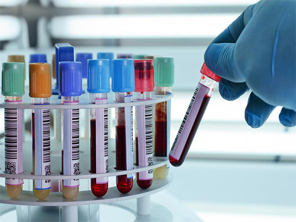 Análisis de laboratorio no te muestra.