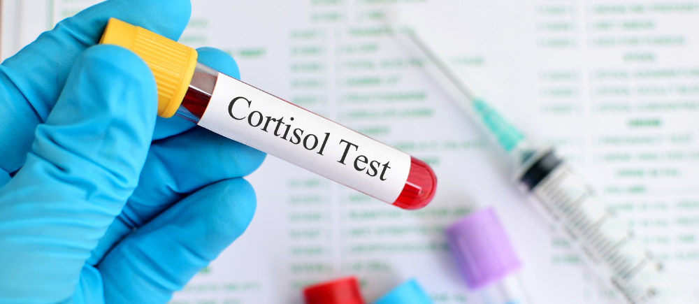 Cortisol Bluttest