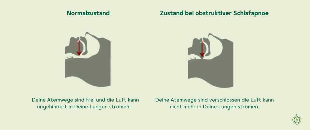 Normalzustand Atem