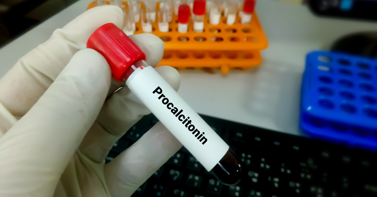 stock-Procalcitonin