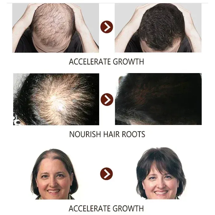 EELHOE 7 Days Germinal Hair Growth Oil 20ml