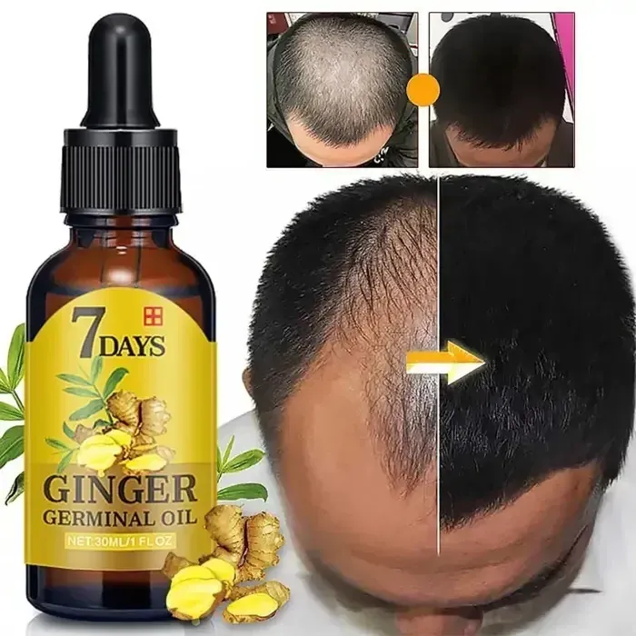 EELHOE 7 Days Germinal Hair Growth Oil 20ml