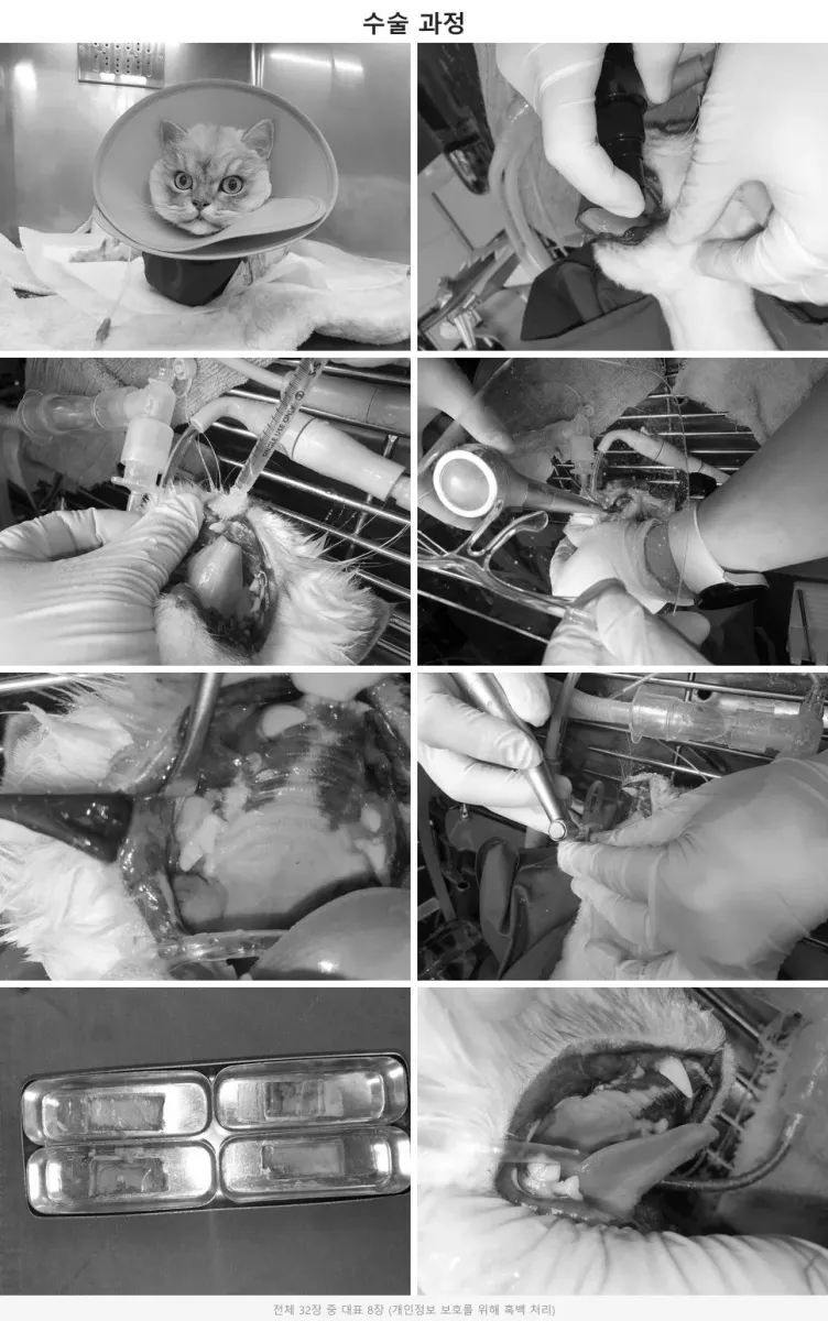 순돌이의 치과 수술 과정을 보여주는 흑백 합성 사진