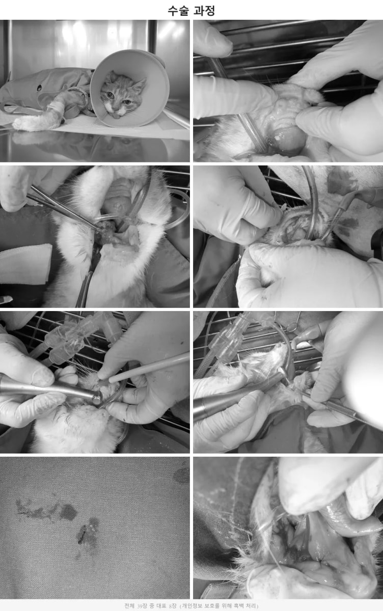 잇몸을 열고 피에조톰을 이용하여 잔존 치근을 안전하게 적출해 내는 고난도 수술 과정