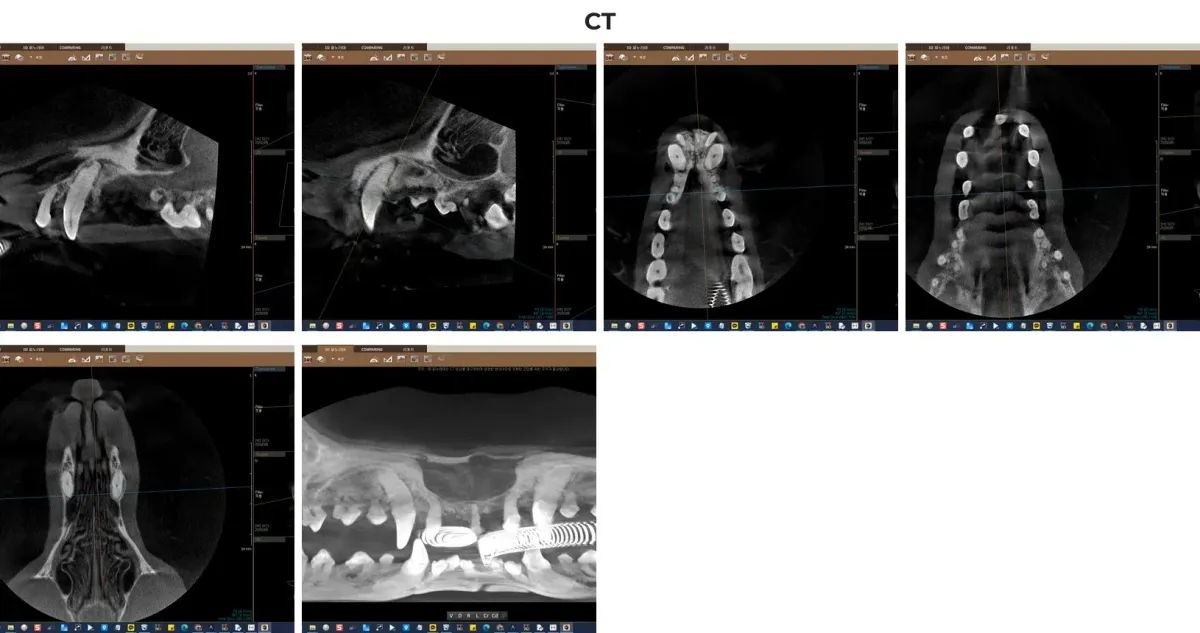 광주 전남 유일 치과 전용 CT를 활용한 만돌이의 3D 턱뼈 및 치근단 평가 영상