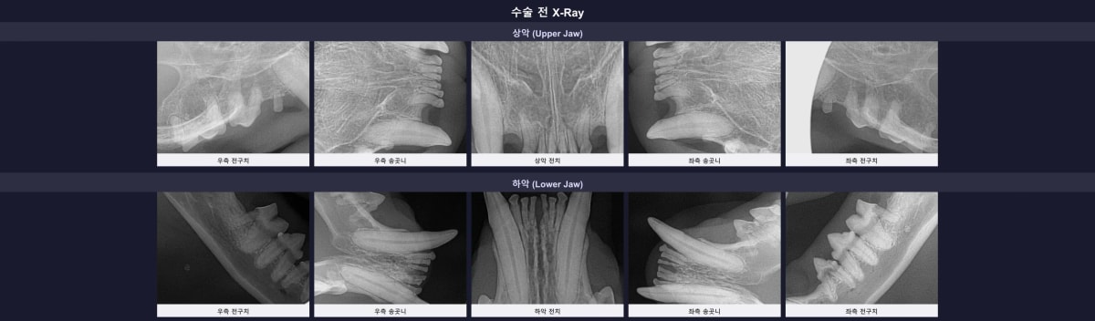 수술 전 하악 송곳니의 치아 흡수성 병변을 보여주는 구강 방사선 엑스레이