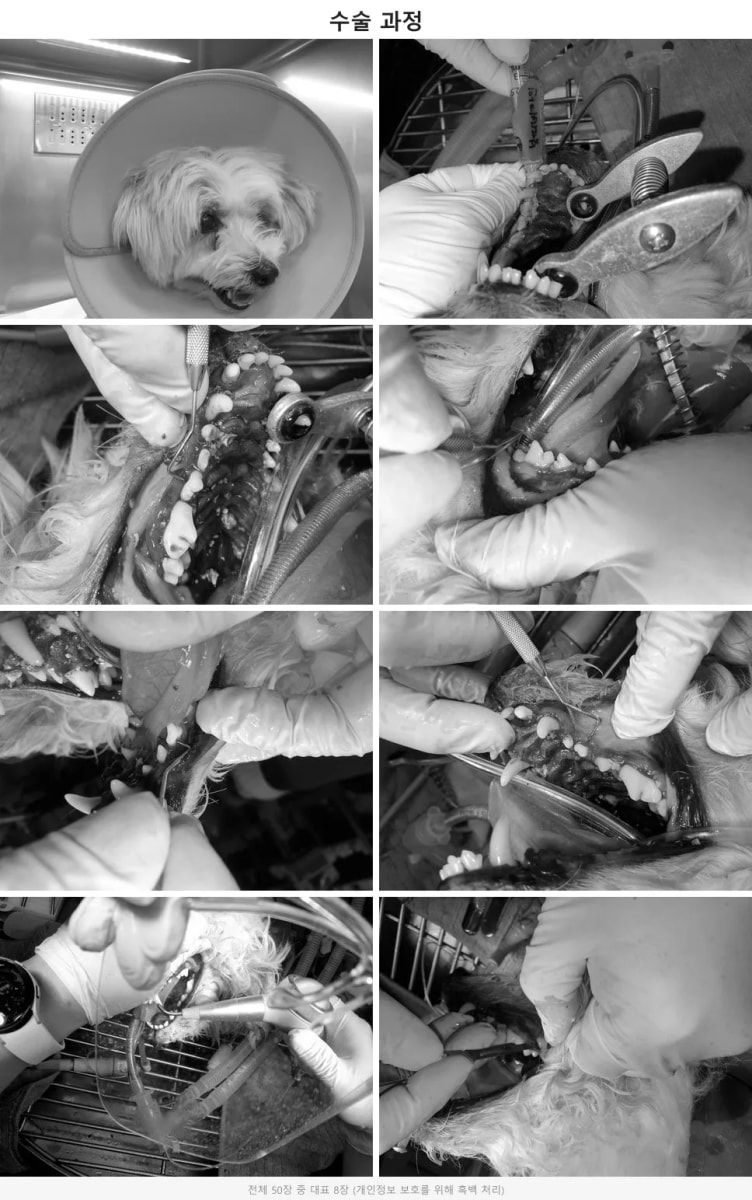 Piezotome과 치과 전용 유닛을 이용한 안전한 외과적 발치 및 엠도게인 시술 과정