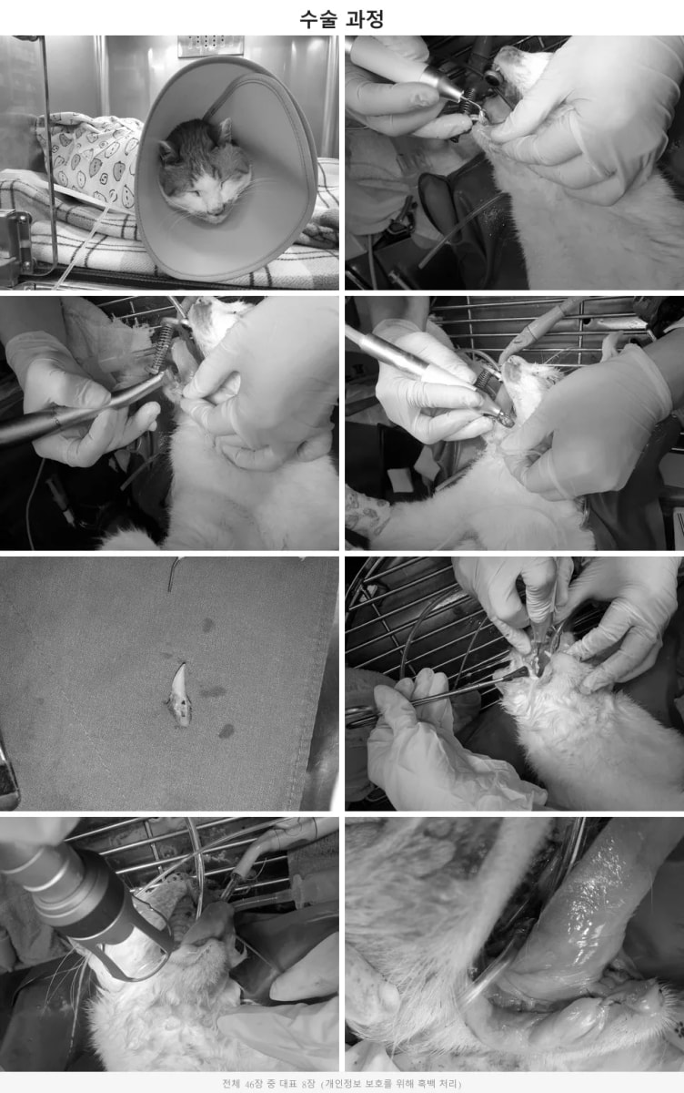 피에조톰을 활용하여 29개 치아를 안전하게 발치 중인 수술 과정