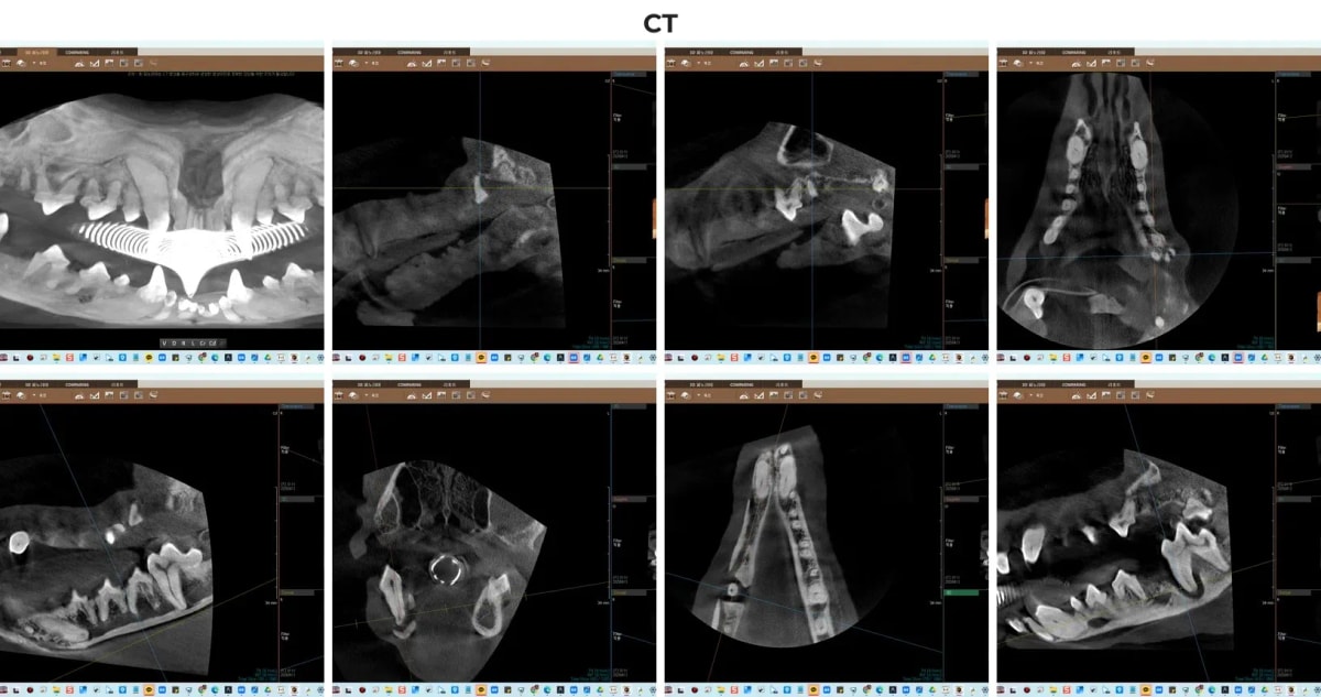 광주 전남 유일 치과 CT를 통한 하루의 3D 턱뼈 및 치근단 정밀 분석 영상