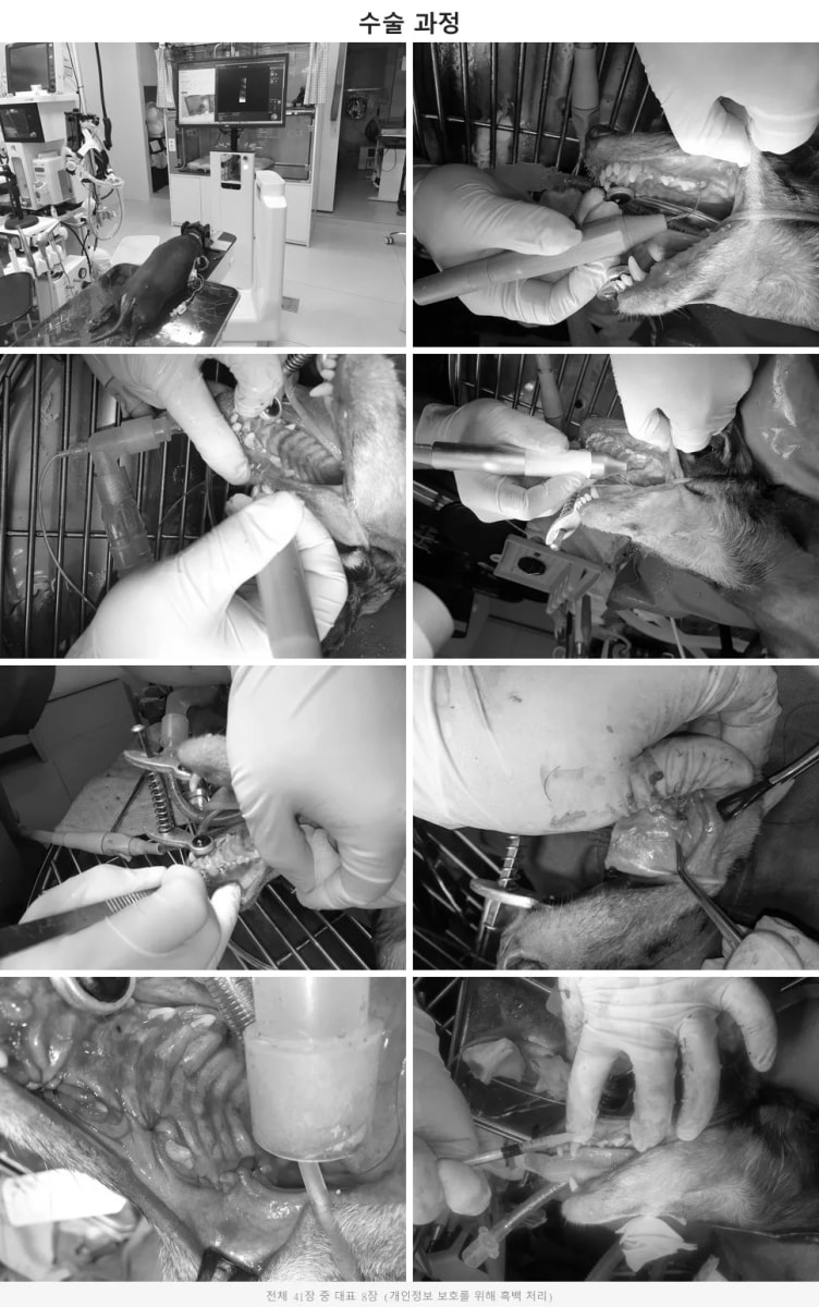 피에조톰을 이용한 정밀 발치 및 엠도게인 인공뼈 이식 수술 과정