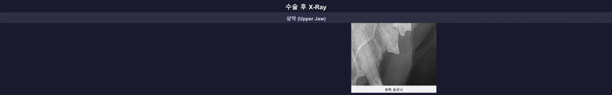 치수 보존 치료 완료 후 구강 엑스레이 및 회복