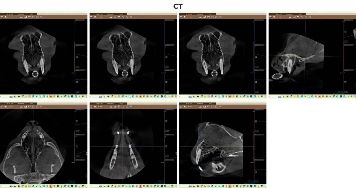 고양이 치과 전용 CT 촬영 결과