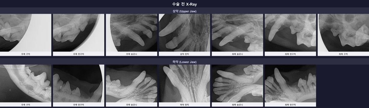 수술 전 구강 엑스레이 소견 및 턱뼈 상태