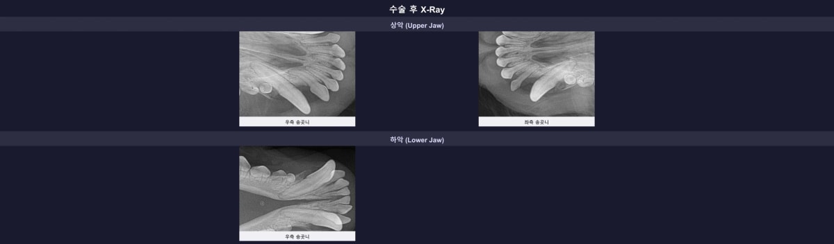 유치 뿌리 없이 완벽하게 발치된 수술 후 구강 엑스레이