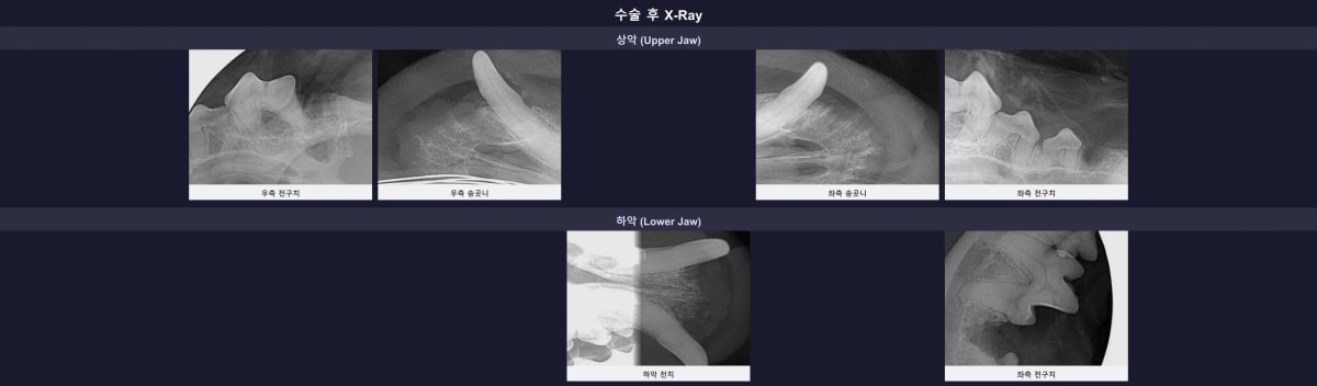 수술 후 잔존 뿌리 없이 깨끗하게 비워진 턱뼈와 보존된 204번 송곳니의 엑스레이 사진
