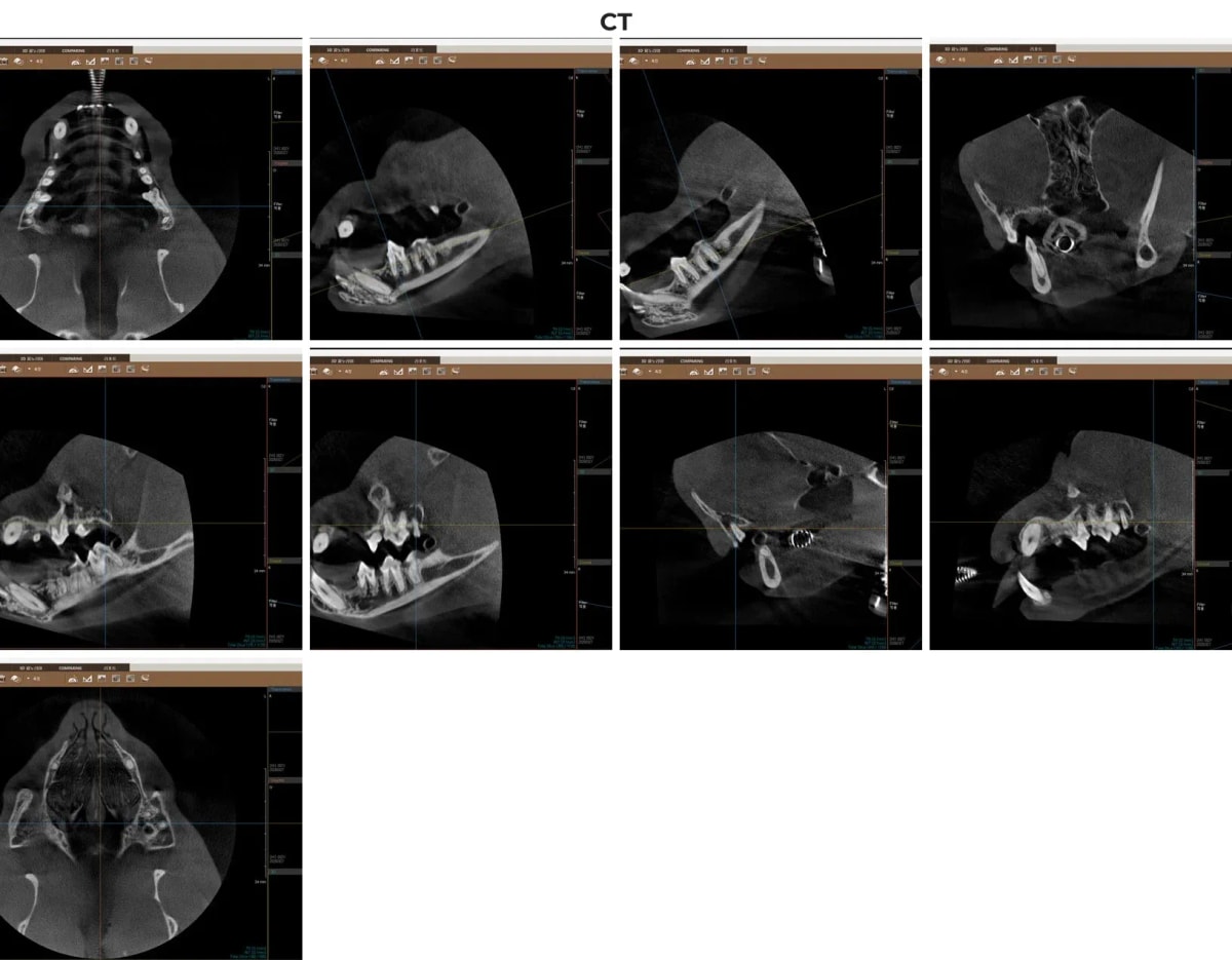 고양이 치아 뿌리 상태를 정밀하게 보여주는 치과 전용 CT 영상 소견