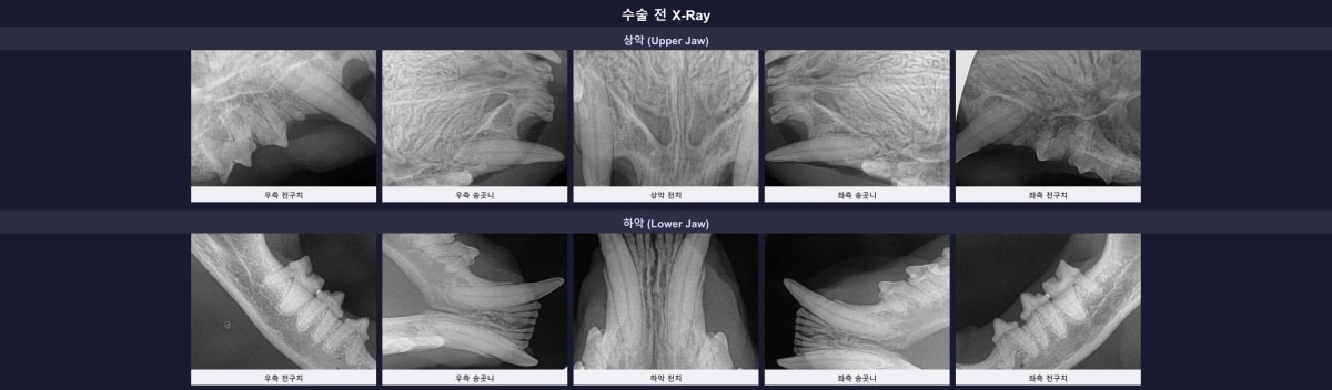 수술 전 정밀 구강 엑스레이 소견