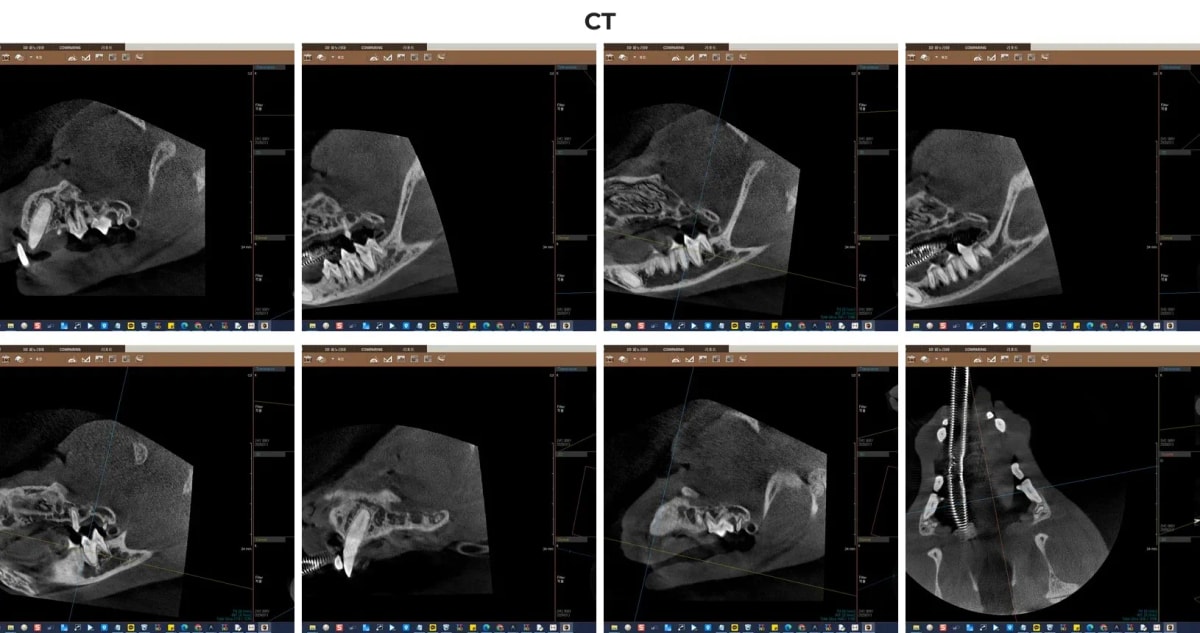 광주 서구 금호동물병원의 정밀 치과 CT 소견
