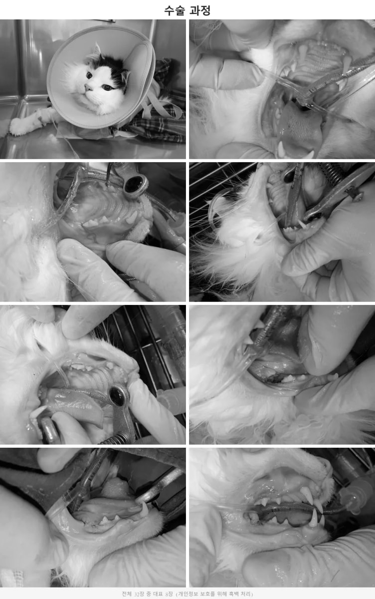 부시의 맞춤형 치과 수술 진행 과정