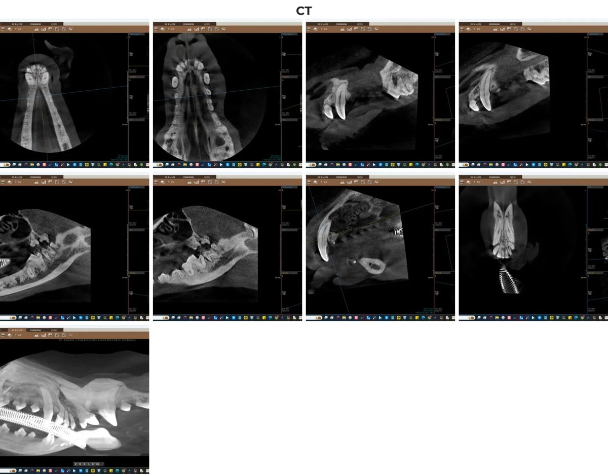 루피의 치과 CT 정밀 스캔 화면