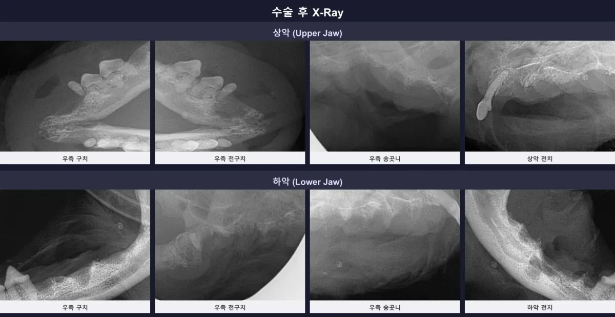 성공적인 발치 후 확인된 우유의 수술 후 X-ray 방사선 사진