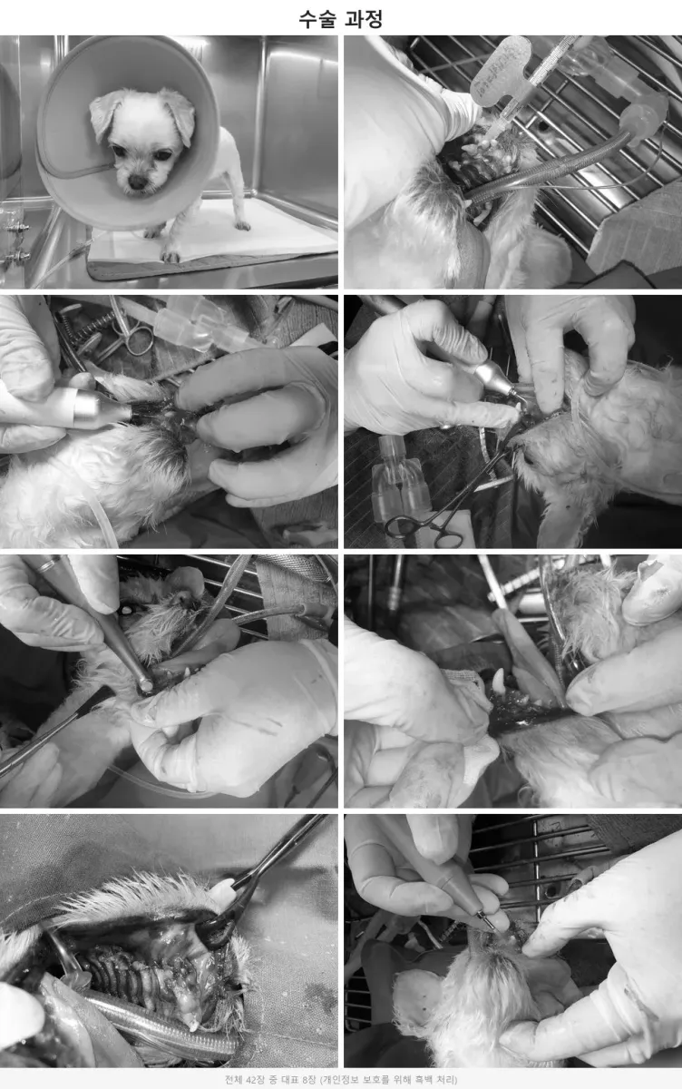 Piezotome과 치과 전용 유닛을 활용한 외과적 다발성 발치 수술 과정