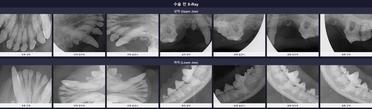 수술 전 전체 구강 방사선 검사 (X-ray) 이미지