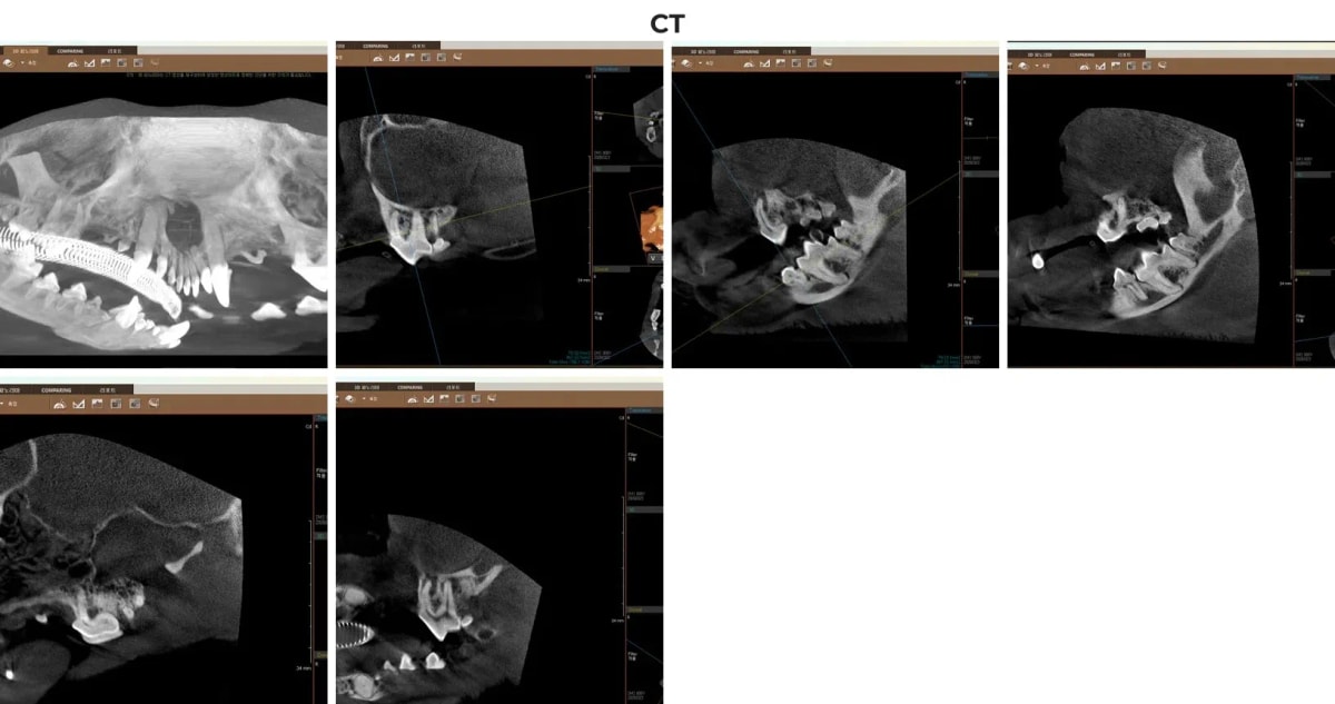 크롱이의 치과 전용 CT 스캔 이미지 (치근단 농양 확인)
