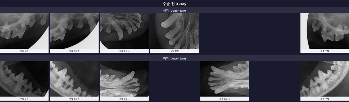 수술 전 치과 방사선 영상 및 치조골 흡수 소견