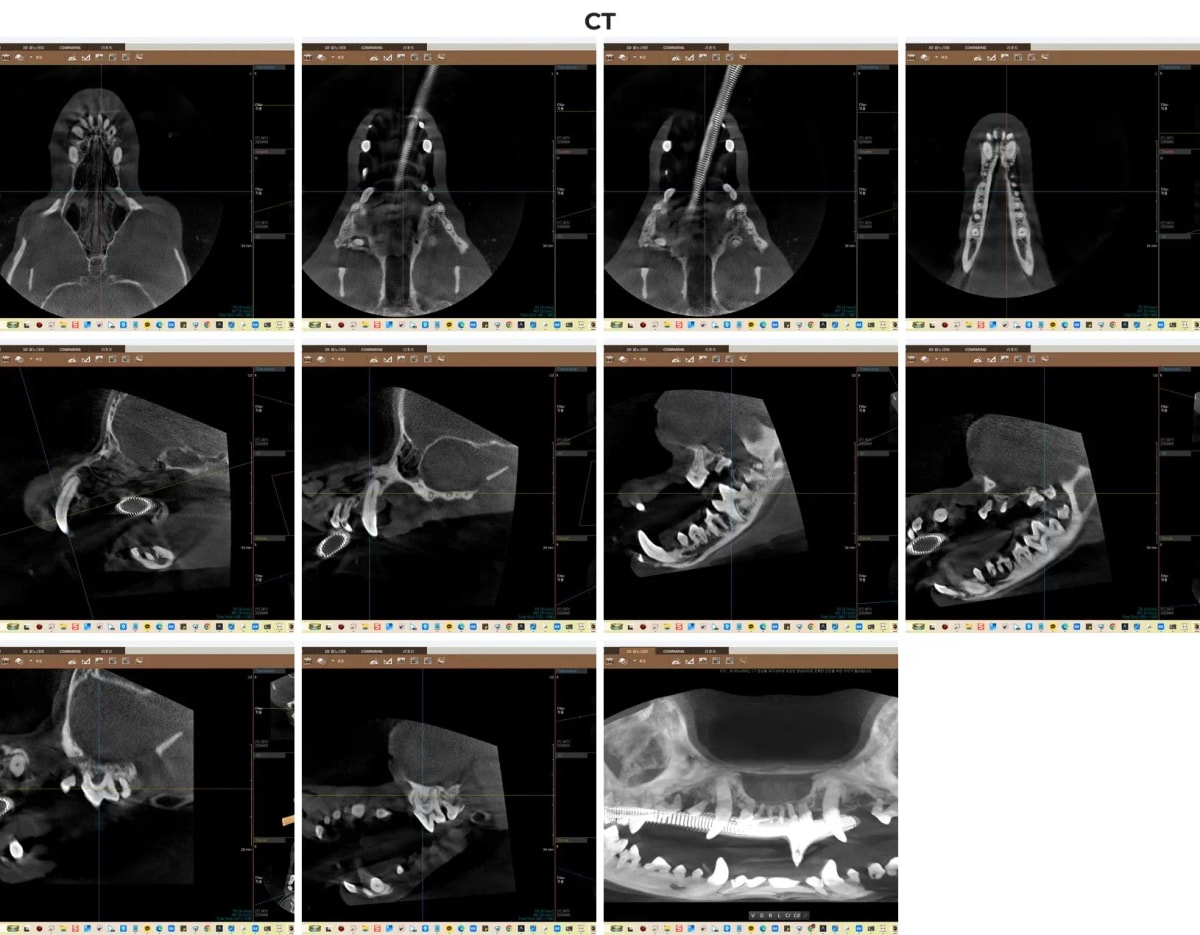 광주 전남 유일 치과 CT를 통한 3D 정밀 분석