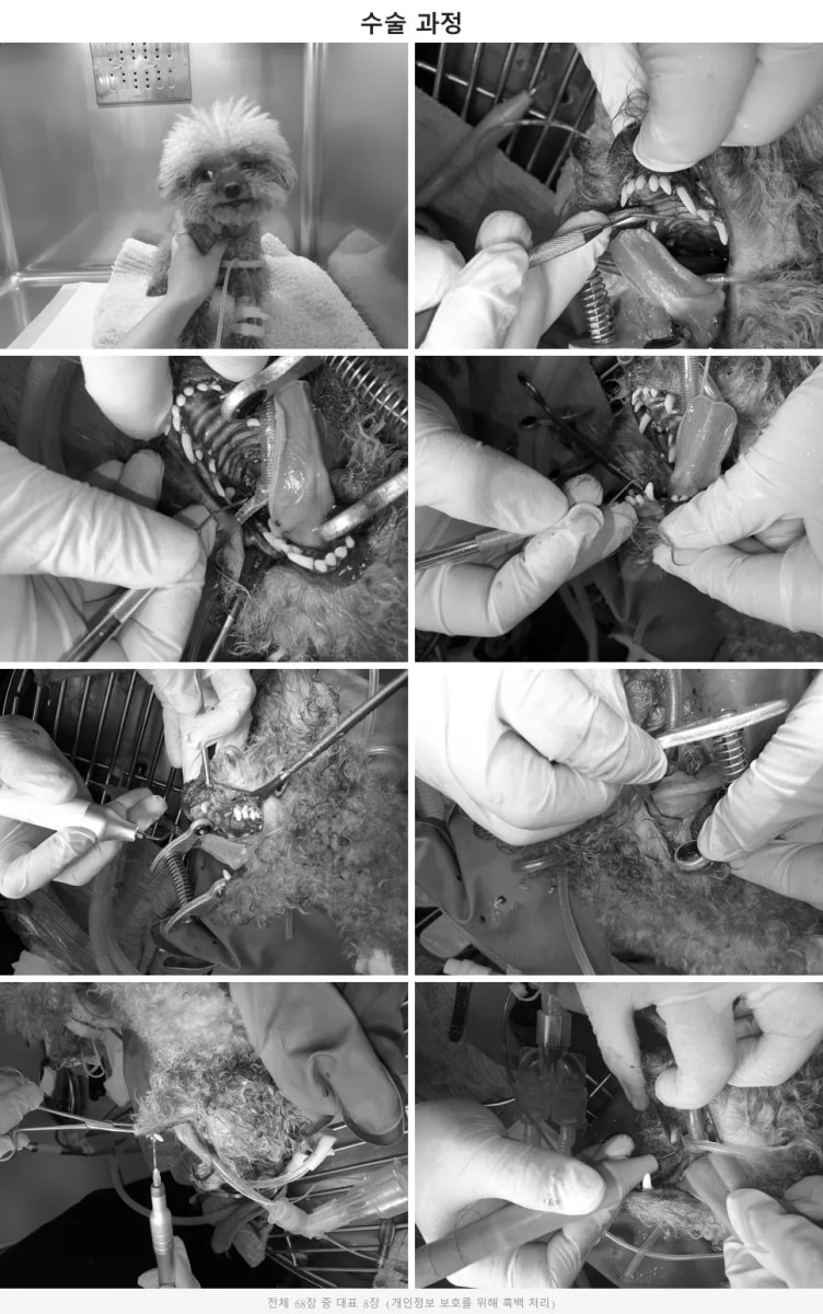 안전한 발치와 치주낭 내 항생제 주입 수술 과정