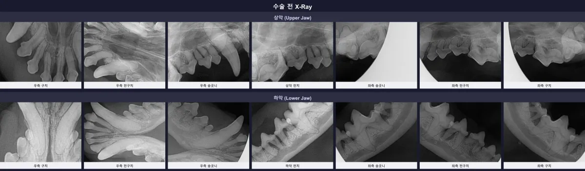 수술 전 환자의 전체 구강 방사선(X-ray) 판독 사진