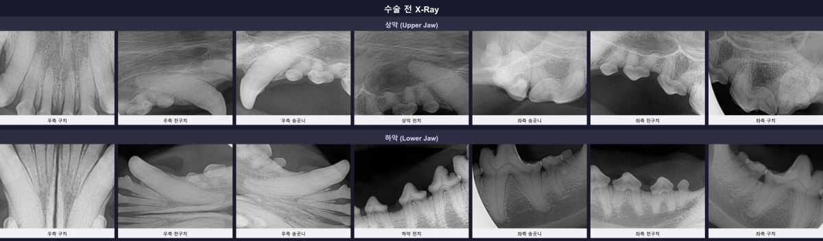수술 전 구강 엑스레이 소견: 치조골 흡수 및 법랑질 손상 부위 확인
