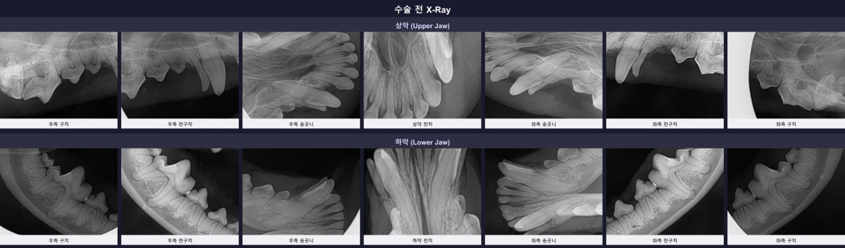 수술 전 치과 방사선 사진
