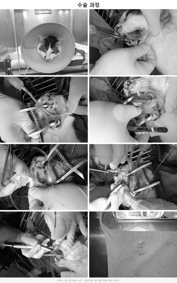 외과적 발치가 진행 중인 수술 과정