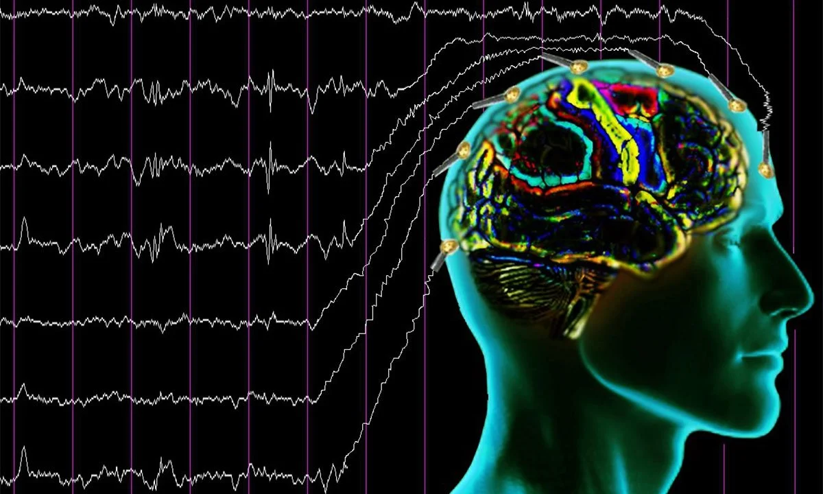EEG Nedir, Nasıl ve Ne İçin Çekilir?