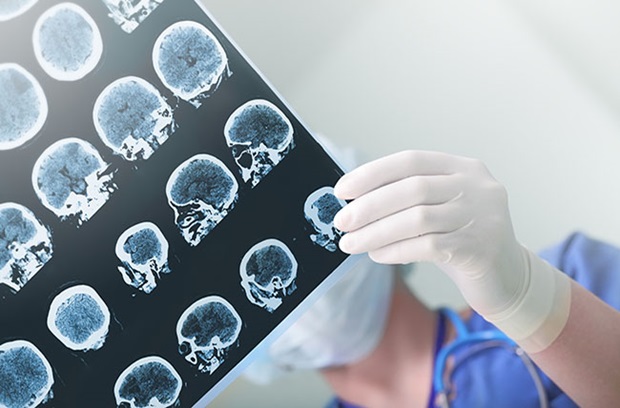 Epilepsi Nedenleri