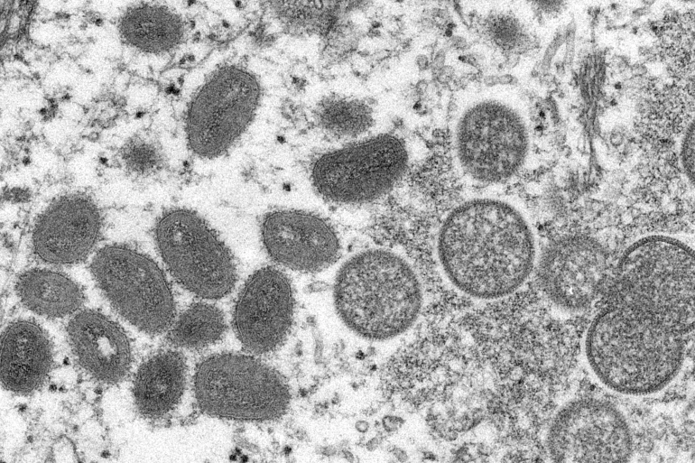 Monkeypox (Mpox) Virus
