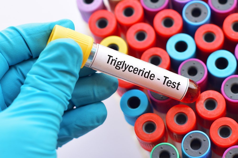 Trigliserit Testi