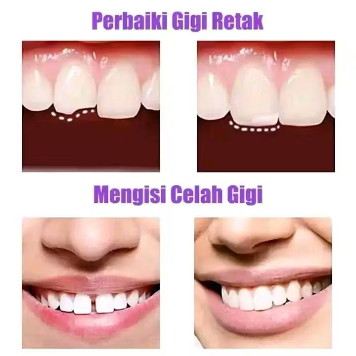 Sesudah