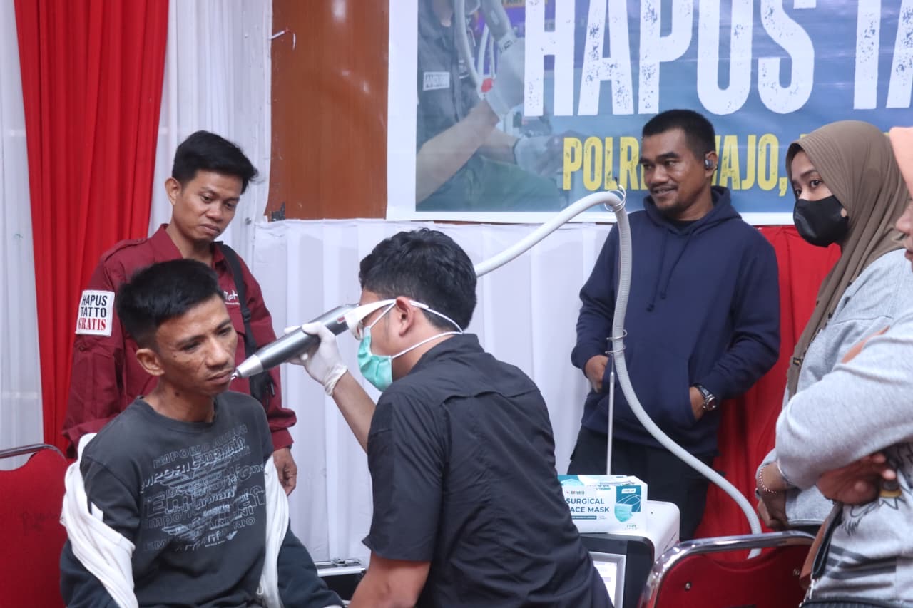 Kolaborasi Polres Wajo dan Komunitas Mahtan: Layanan Hapus Tato untuk Publik