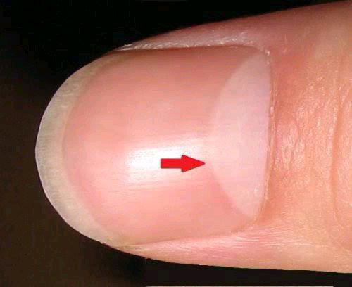 Published from Blogger Prime Android App