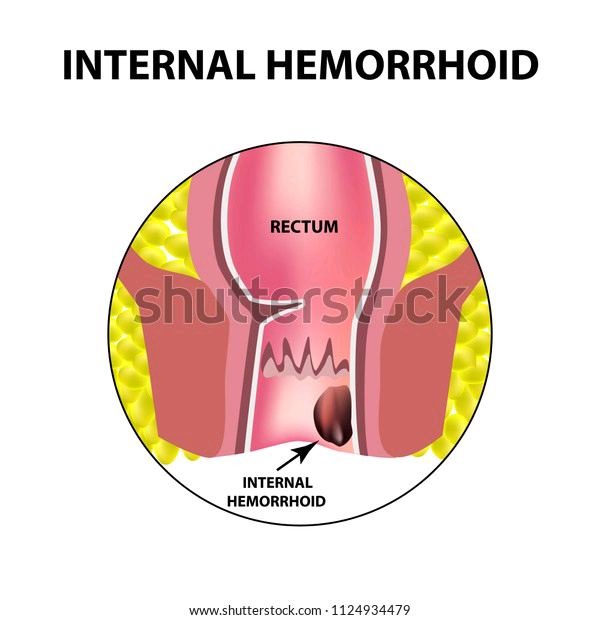 Published from Blogger Prime Android App