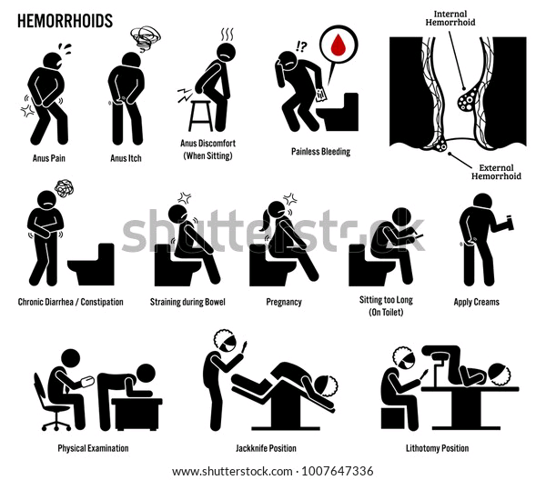 Published from Blogger Prime Android App