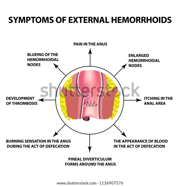 Published from Blogger Prime Android App