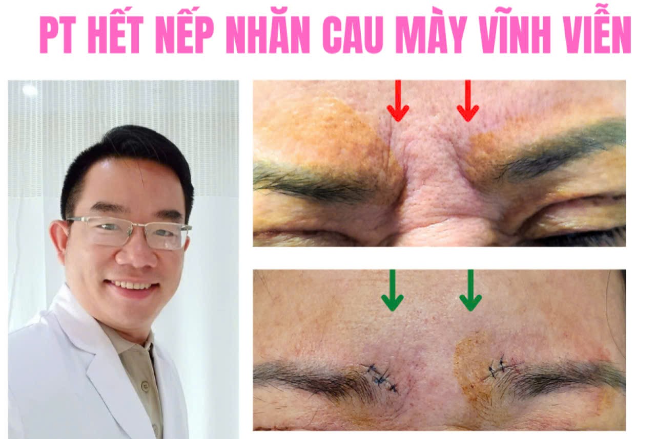 Published from Blogger Prime Android App